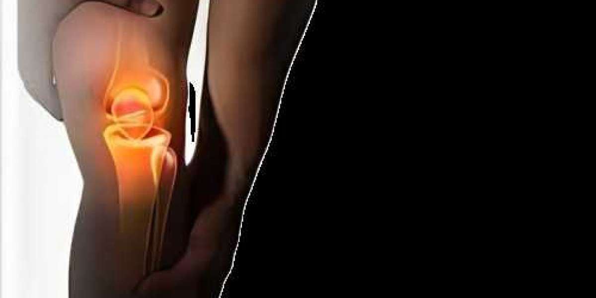Affordable knee replacement cost in Turkey at Yapita Healt